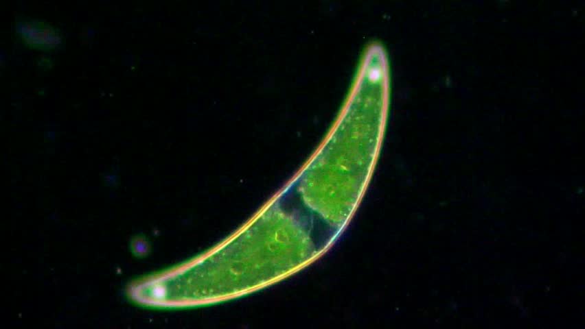 Live Green Closterium Alga Under Microscope, Magnification ...