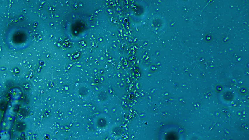 Best of Sperm cells 400x 400x Sperm cells