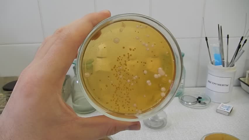 посев в лаборатории постановка бак посева мочи в лаборатории