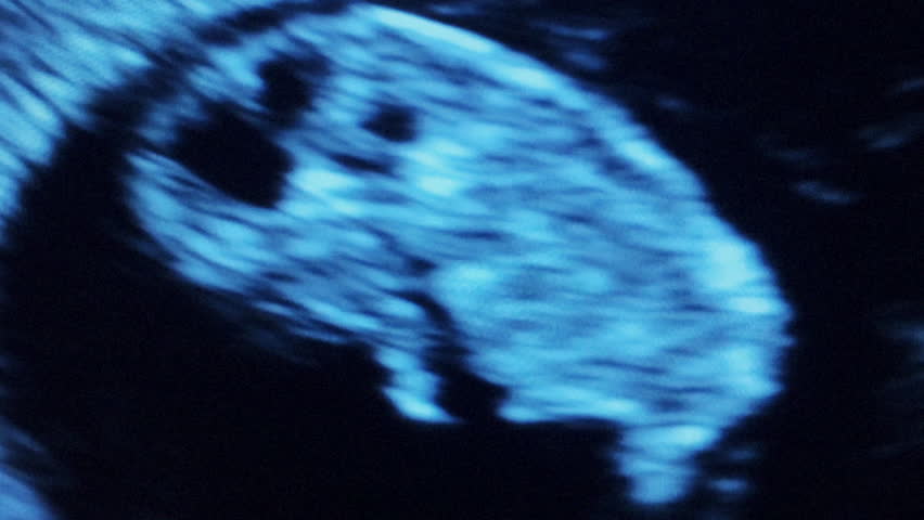 Ultrasound Of Baby And Pregnancy, Visible Beating Heart Stock Footage ...